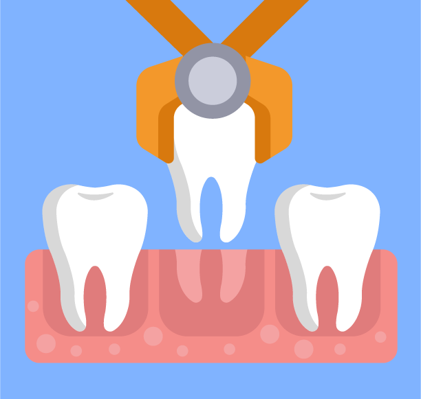 tooth extractions